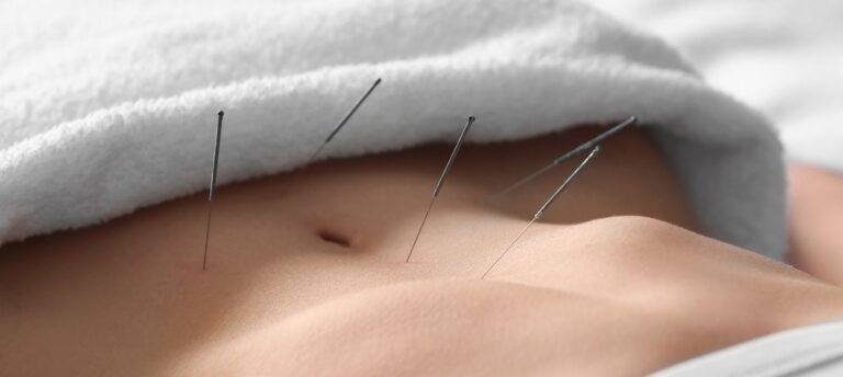 trattamento di agopuntura per la fertilità in un percorso di PMA e fecondazione assistita